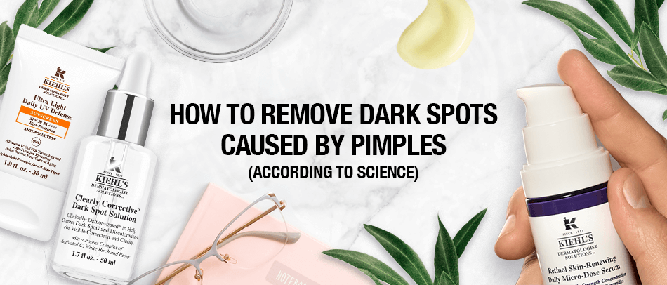 How to Remove Dark Spots Caused by Pimples (According to Science)