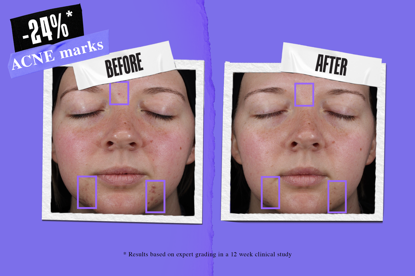 Emulsion Image
